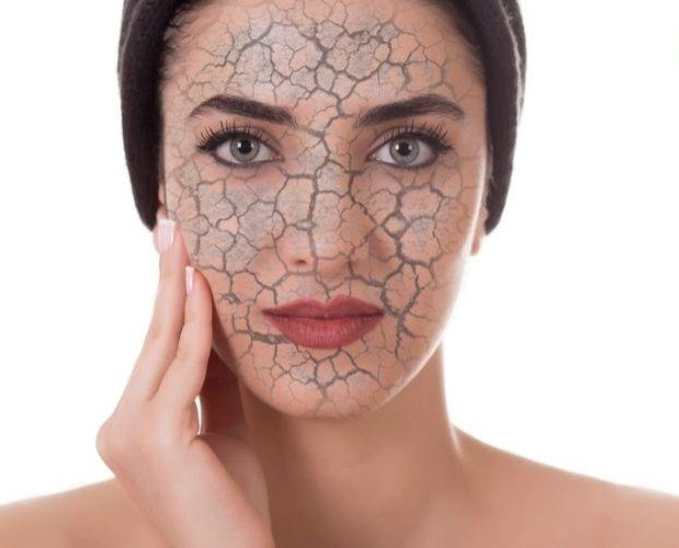 مراقبت از پوست خشک
